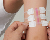 Dispositivo de cierre de heridas de sutura con puntada de cremallera no invasiva Cierre de piel Tela no tejida color blanco tamaño estándar