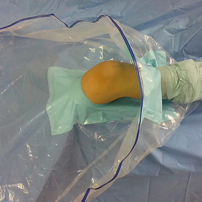 El Arthroscopy quirúrgico disponible médico de la rodilla cubre el paquete/equipo
