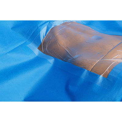 Conjunto de paquetes de cesárea quirúrgica estéril Conjunto de cortinas quirúrgicas cesáreas