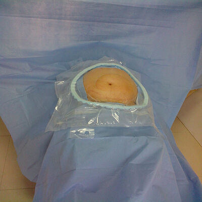 Envases quirúrgicos desechables de alta absorción con zonas críticas de absorción reforzadas y esterilización de EO para emergencias hospitalarias